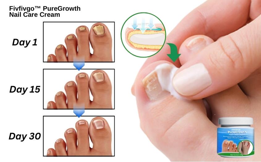 Fivfivgo™ PureGrowth Crème pour le soin des ongles
