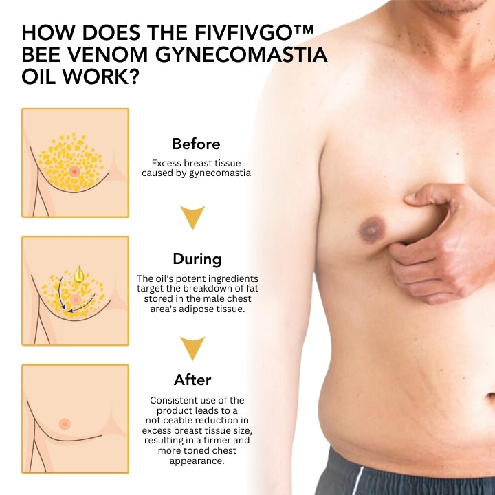 Fivfivgo™ Bee Venom Gynecomastia Oil