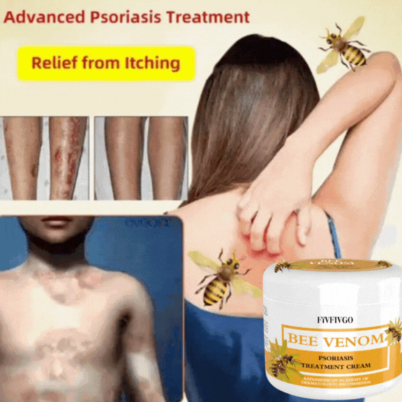 Fivfivgo™ BeeVenom Psoriasis Crème de solution