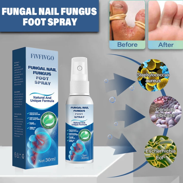 Fivfivgo™ Anti-Fungal Nail Treatment Spray