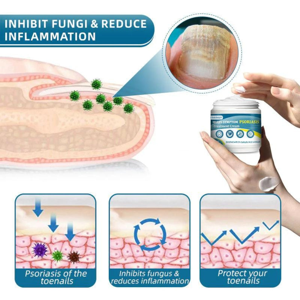 Fivfivgo™ Multi-Symptom-Psoriasis-Behandlungscreme