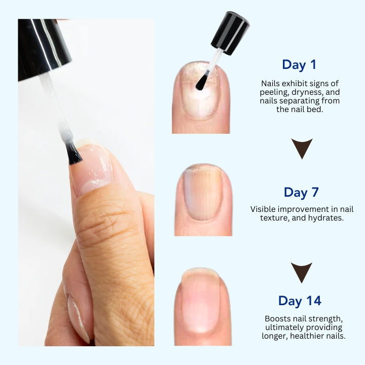 Fivfivgo™ OnyxoGuard Sérum de croissance et de réparation des ongles