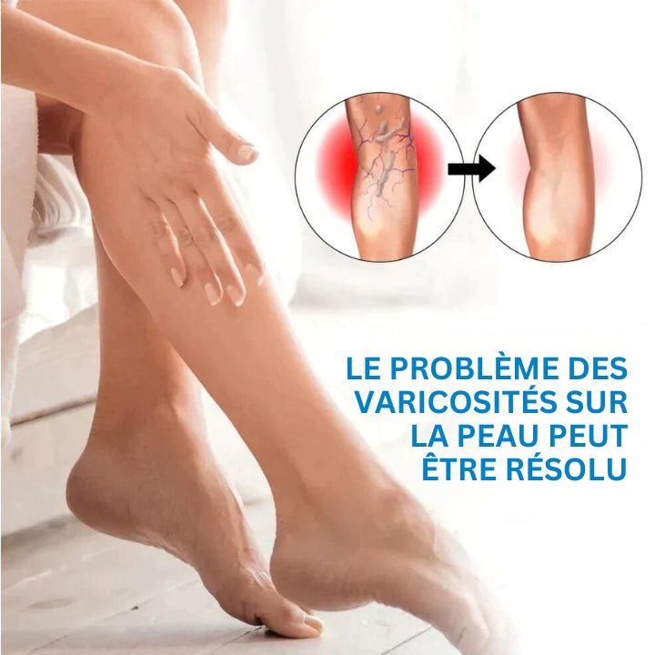 Fivfivgo™ Spray contre les varices