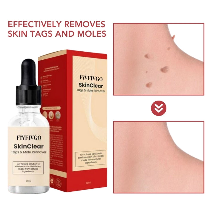 Fivfivgo™ SkinClear Tags & Mole Remover