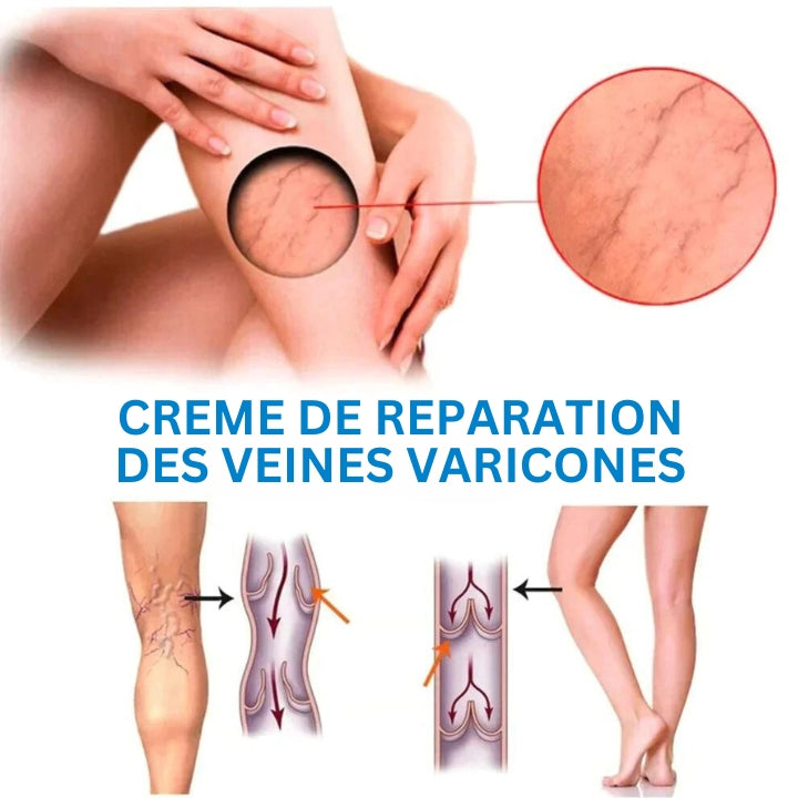 Fivfivgo™ Spray contre les varices