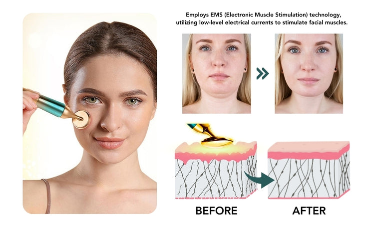 Fivfivgo™ VorSculpt V-Face Contouring Device