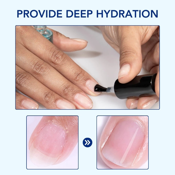 Fivfivgo™ OnyxoGuard Sérum de croissance et de réparation des ongles
