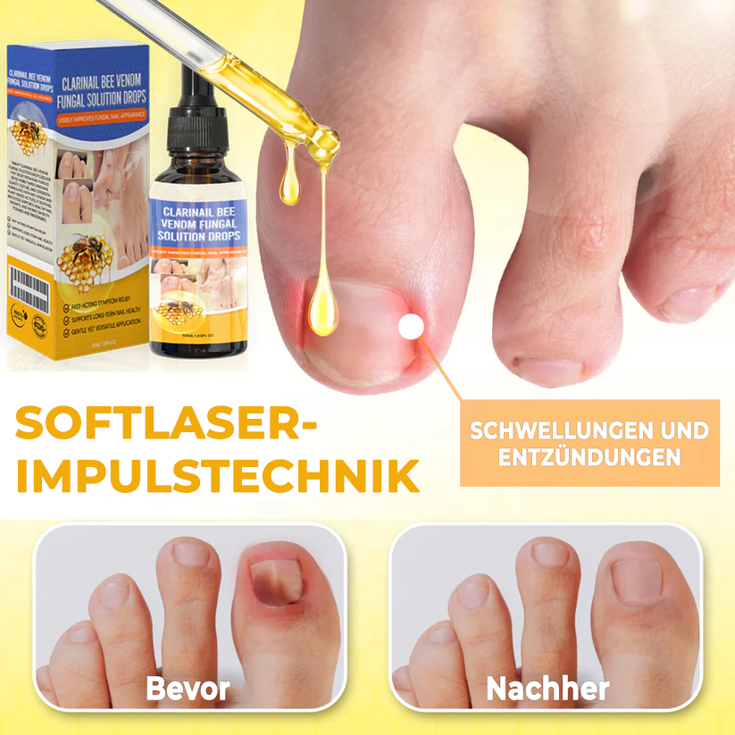 Fivfivgo® ClariNail Bienengift-Pilzlösungstropfen