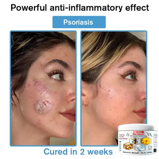 Fivfivgo™ Bee Venom Multi-Symptom Treatment Cream