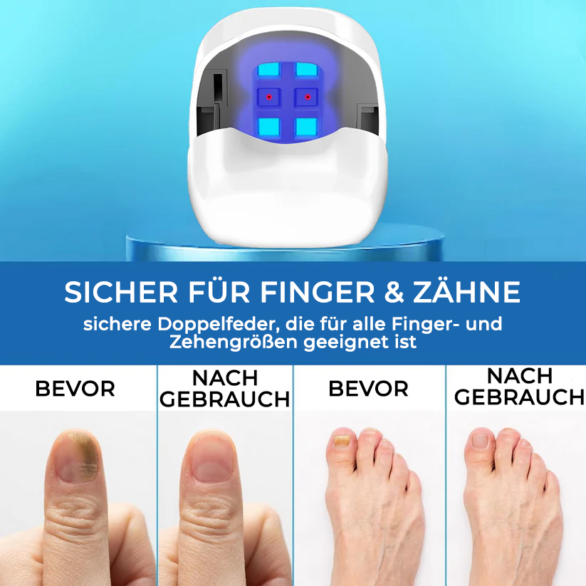 Bikenda® Nagelpilz Laser-Behandlungsgerät