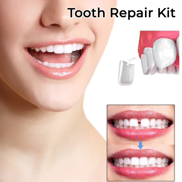 Fivfivgo™ Zahnprovisorische Kronenveneers
