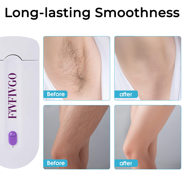 Fivfivgo™ Cordless Hair Epilator