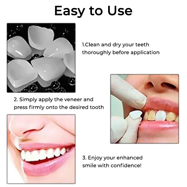 Fivfivgo™ Dental Temporary Crown Veneers
