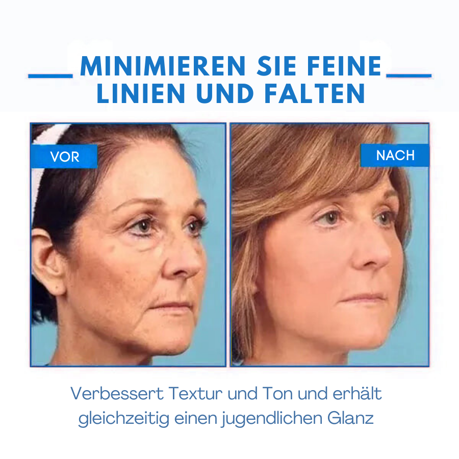 Fivfivgo™ Ultra straffende und revitalisierende Creme (erneuert die Festigkeit der Haut)