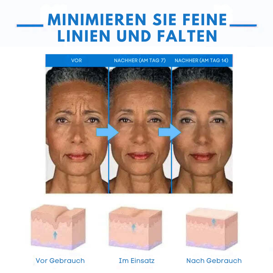 Fivfivgo™ Ultra straffende und revitalisierende Creme (erneuert die Festigkeit der Haut)