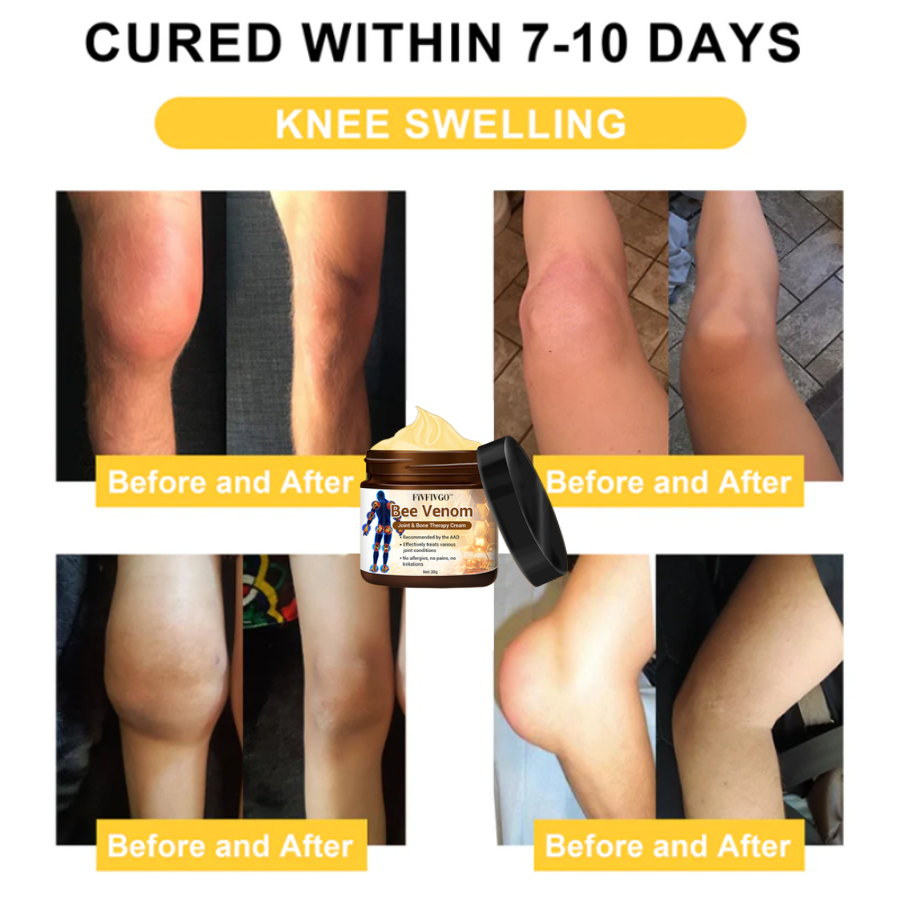 Fivfivgo™ Bee Venom Arthritis Therapy Cream (Specially for older adults & AAOS recommends)🔥