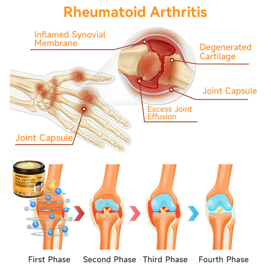 Fivfivgo™ Bee Venom and Turmeric Joint and Bone Pain Relief Cream (Specialized in Joint and Arthritis Pain & Recommended by AAOS)
