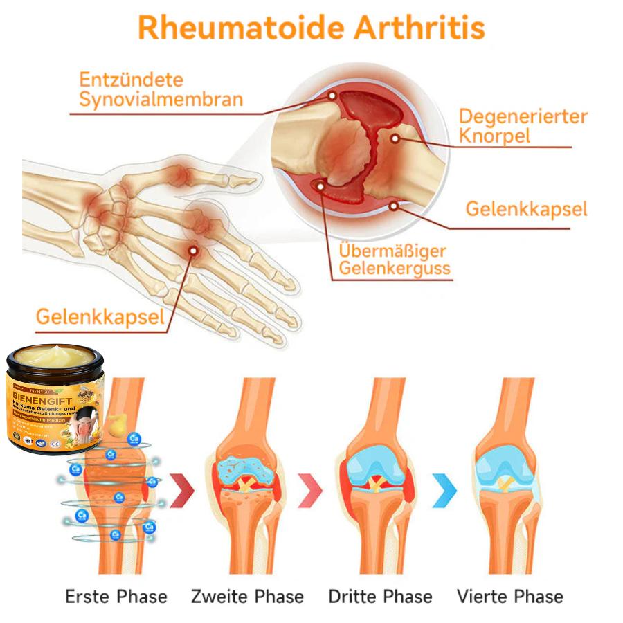 Fivfivgo™ Bienengift- und Kurkuma-Gelenk- und Knochenschmerzlinderungscreme (Spezialisiert auf Gelenk- und Arthritisbeschwerden & empfohlen von der AAOS)