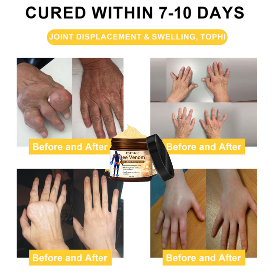 Fivfivgo™ Bee Venom Arthritis Therapy Cream (Specially for older adults & AAOS recommends)🔥