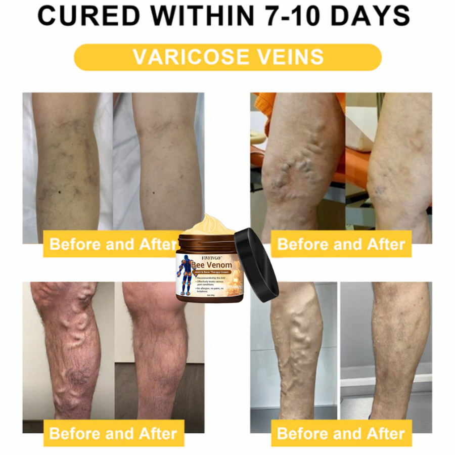Fivfivgo™ Bee Venom Arthritis Therapy Cream (Specially for older adults & AAOS recommends)🔥