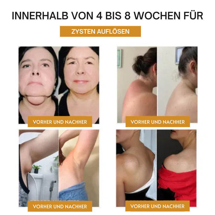 Fivfivgo™ Ultraschall-Armband zur Fettverbrennung und Entgiftung - Energiebilanz
