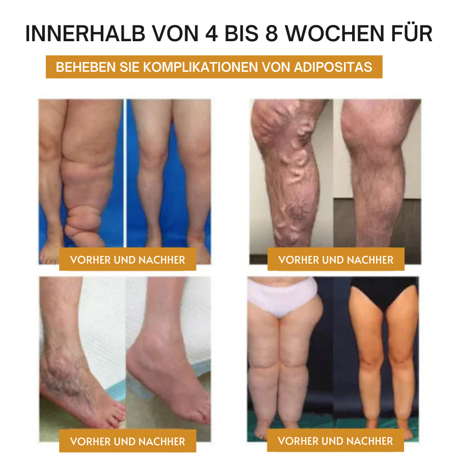 Fivfivgo™ Ultraschall-Armband zur Fettverbrennung und Entgiftung - Energiebilanz