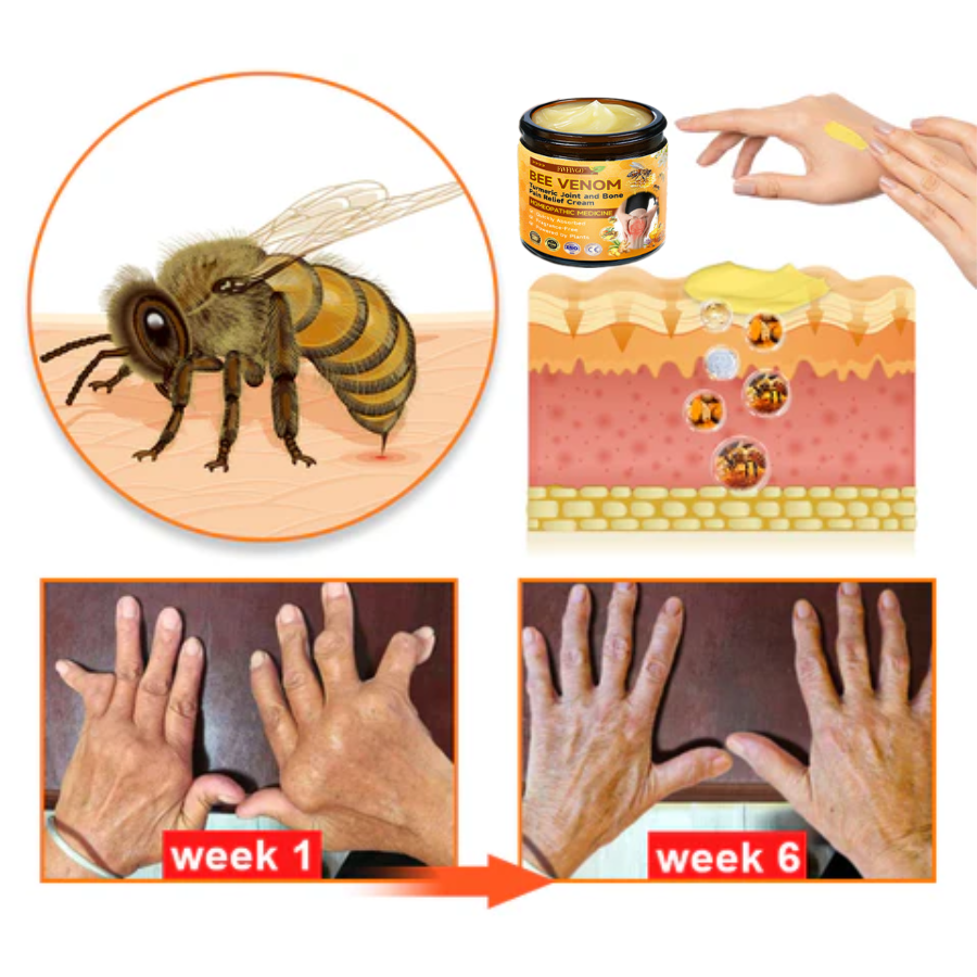 Fivfivgo™ Bee Venom and Turmeric Joint and Bone Pain Relief Cream (Specialized in Joint and Arthritis Pain & Recommended by AAOS)
