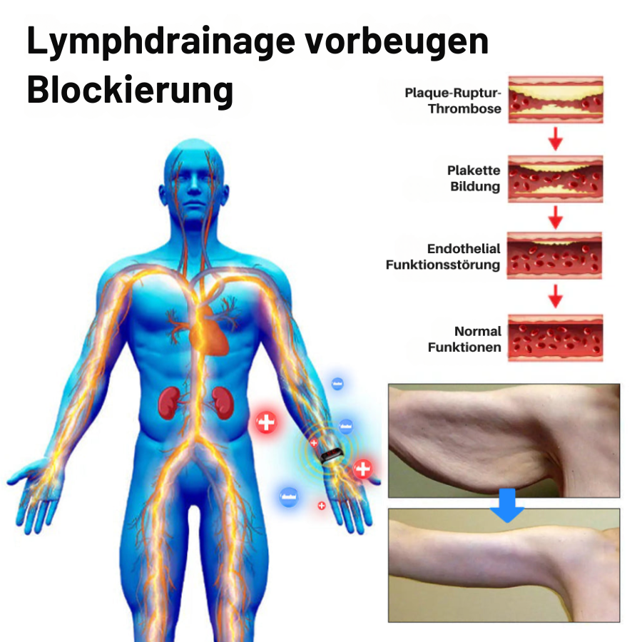 Fivfivgo™ Ultraschall-Armband zur Fettverbrennung und Entgiftung - Energiebilanz