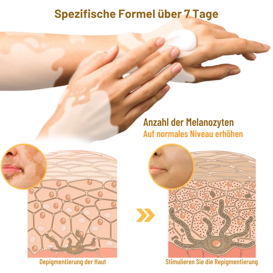 Fivfivgo™ BeeVenom Vitiligo Behandlung Creme