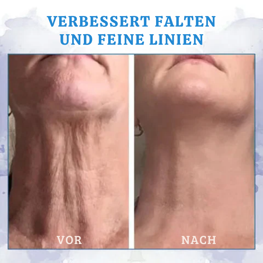 Fivfivgo™ Ultra straffende und revitalisierende Creme (erneuert die Festigkeit der Haut)