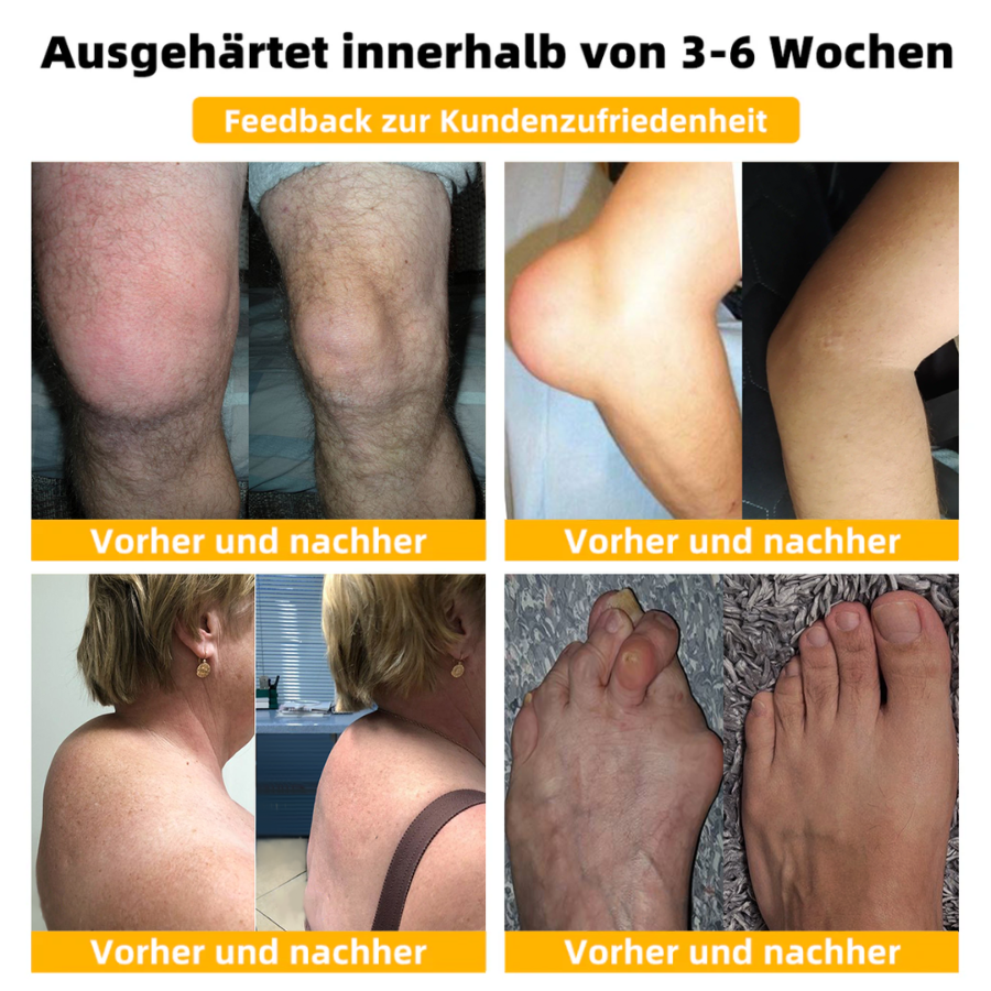 Fivfivgo™ Bienengift Fortgeschrittenes Gelenkt und Knochentherapie-Creme (Neuseeländischer Bienenextrakt - Spezialisiert auf orthopädische Erkrankungen und Arthritisschmerzen)