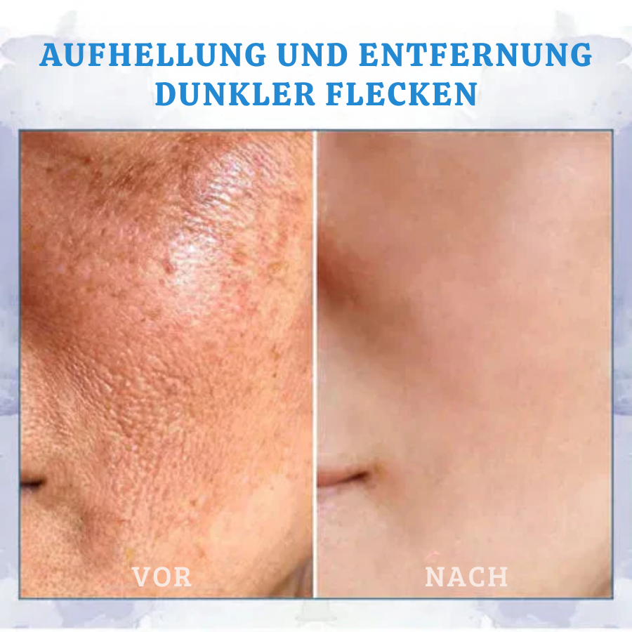 Fivfivgo™ Ultra straffende und revitalisierende Creme (erneuert die Festigkeit der Haut)