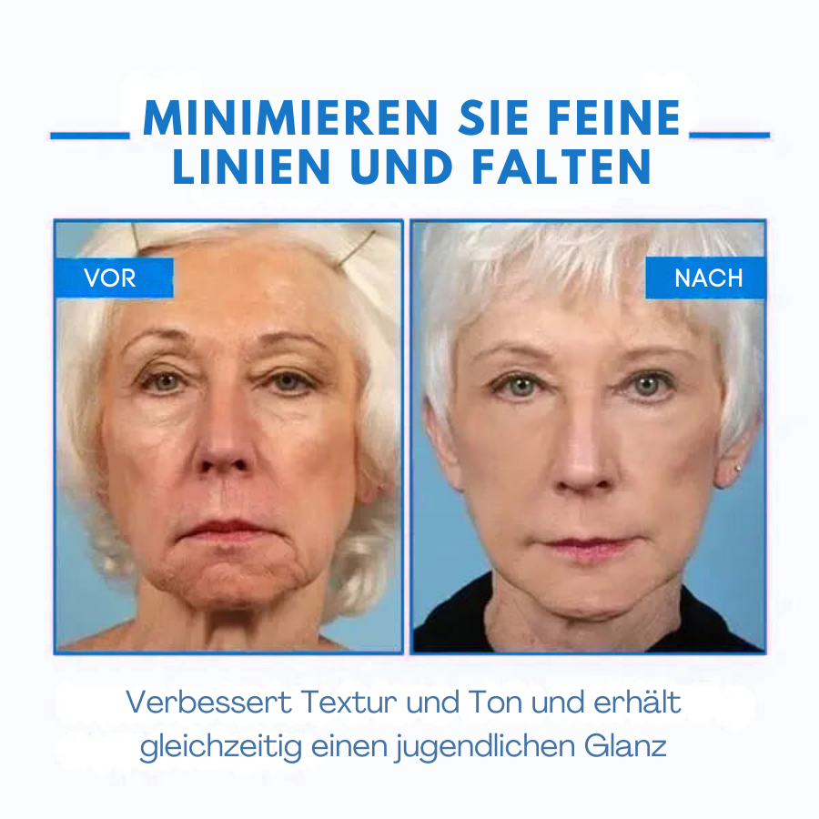 Fivfivgo™ Ultra straffende und revitalisierende Creme (erneuert die Festigkeit der Haut)