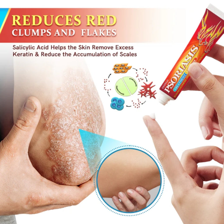 Fivfivgo™ Psoriasis Antibacterial Treatment Cream