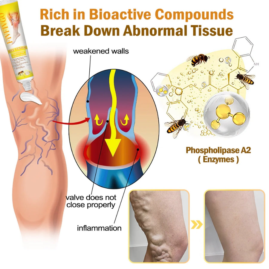 Fivfivgo™ Arthritis und Varikose Behandlung Creme