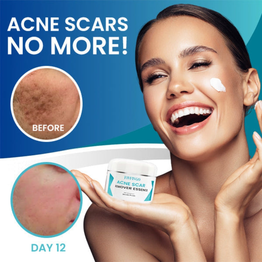 Fivfivgo™ Acne Scar Remover Essence