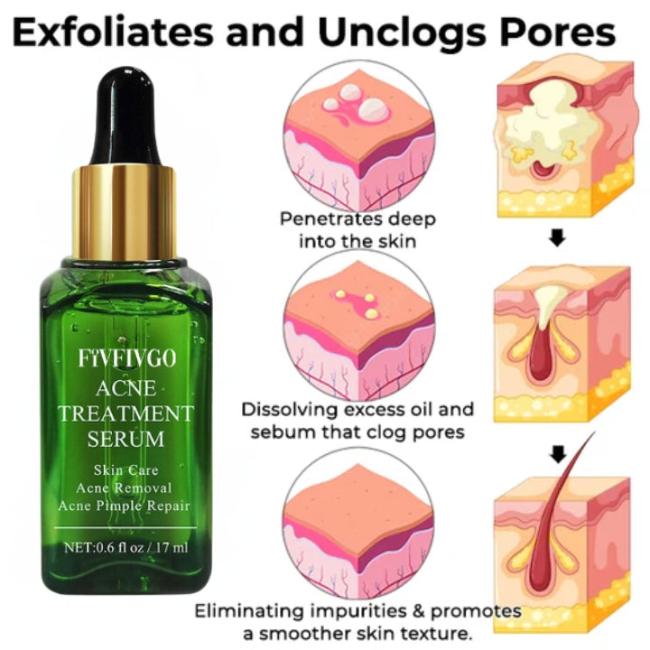 Fivfivgo™ LightenUp Body Acne Serum (for Acne & Spots & Acanthosis Nigricans Removal)