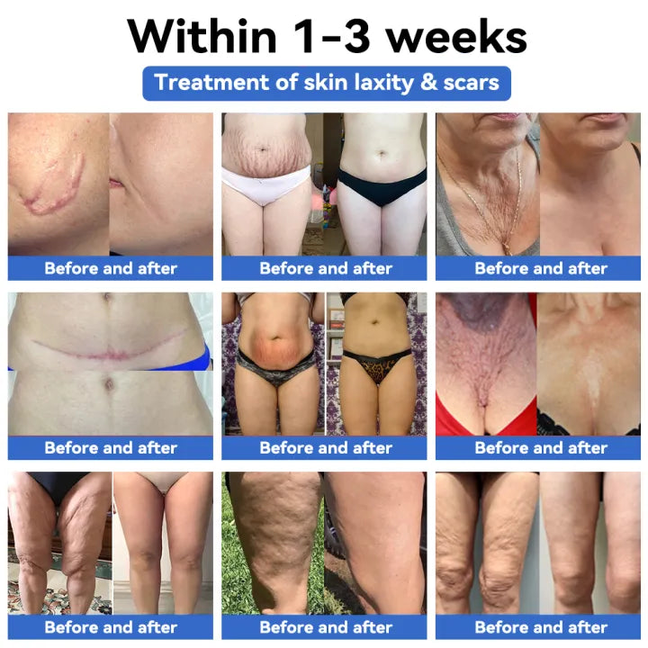 Fivfivgo™ Luxury Slimming Body Lotion