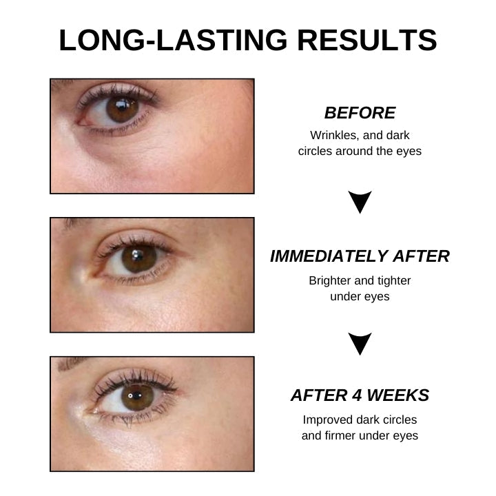 Fivfivgo™ Gel tenseur instantané pour les yeux