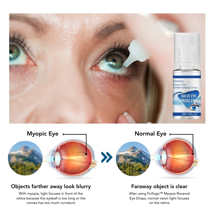 Fivfivgo™ Myopie Gouttes oculaires réversibles
