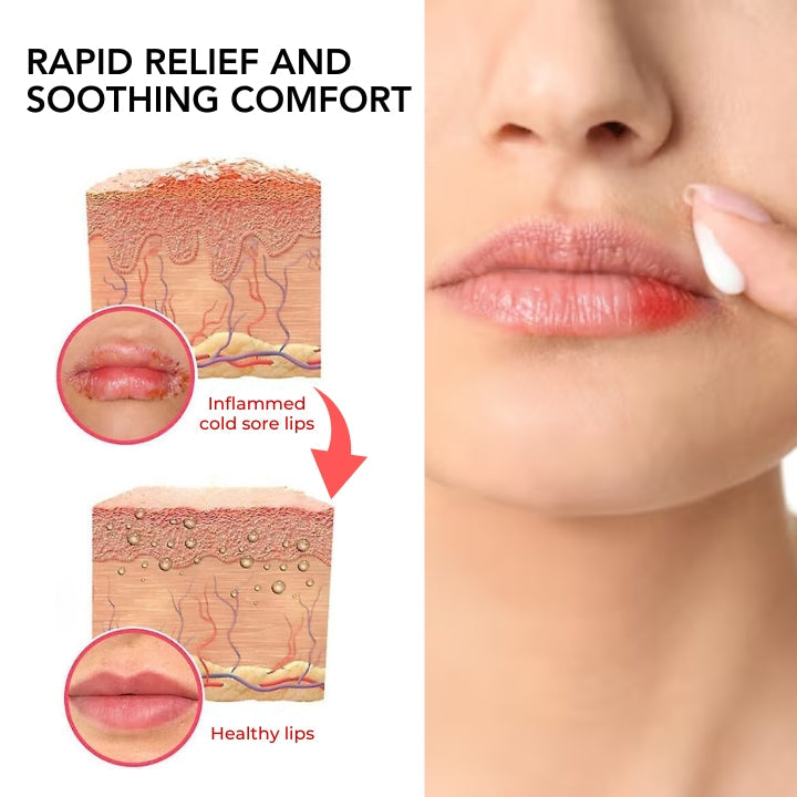 Fivfivgo™ Cheilitis Behandlung Creme