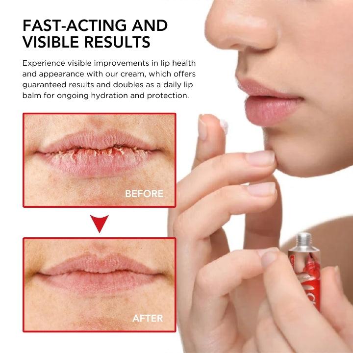 Fivfivgo™ Cheilitis Treatment Cream