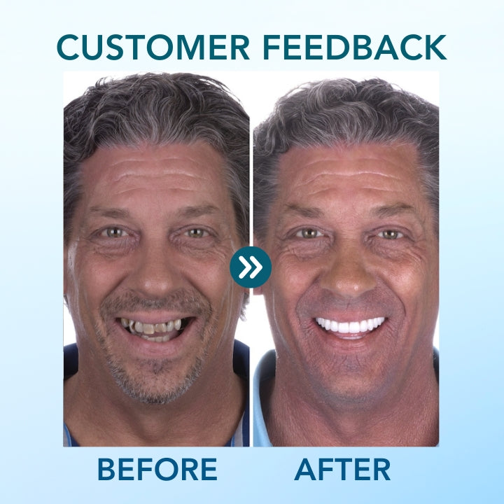 Fivfivgo™ Composant logiciel enfichable Dentiers