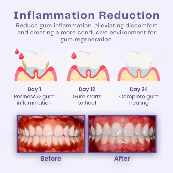 Fivfivgo™ Gumtify Therapy Gel