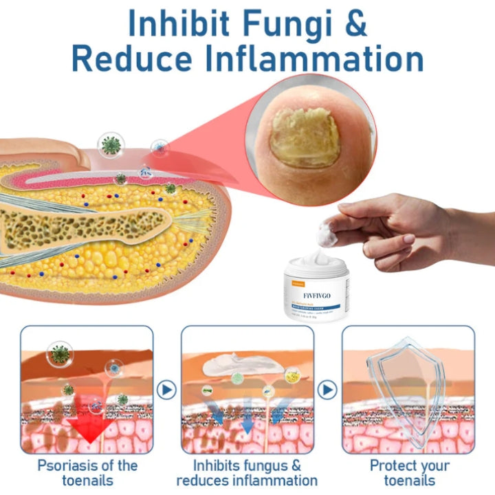 Fivfivgo™ Psoriasis Crème Hydratante et Apaisante