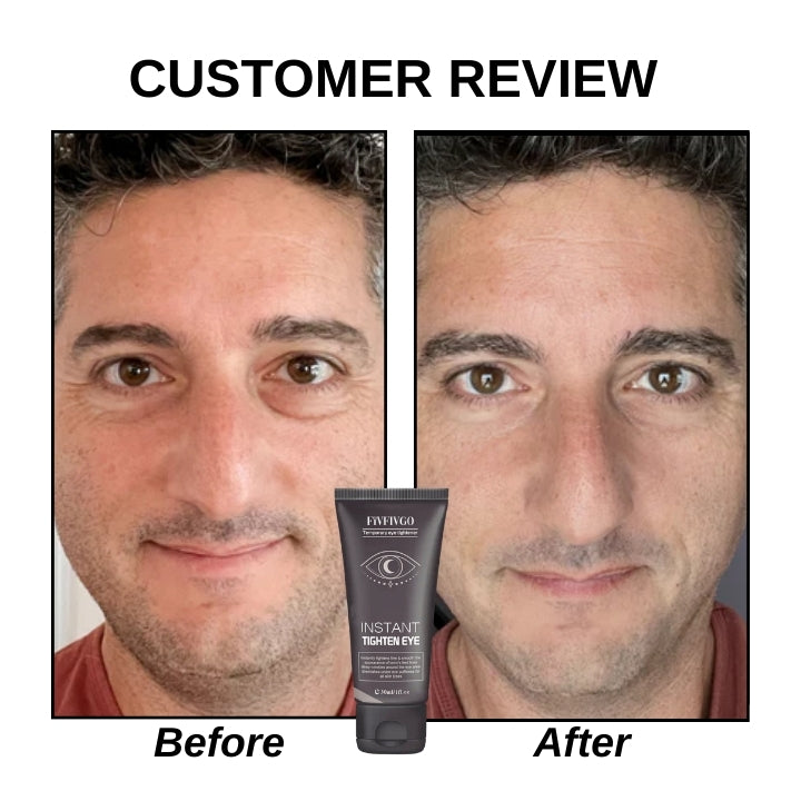Fivfivgo™ Gel tenseur instantané pour les yeux