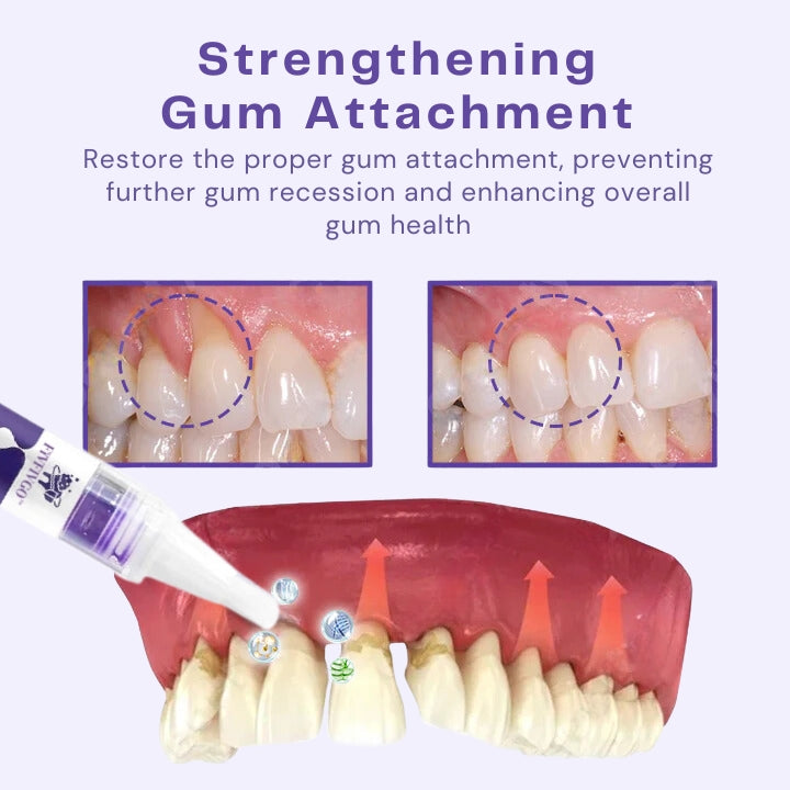 Fivfivgo™ Gumtify Therapy Gel