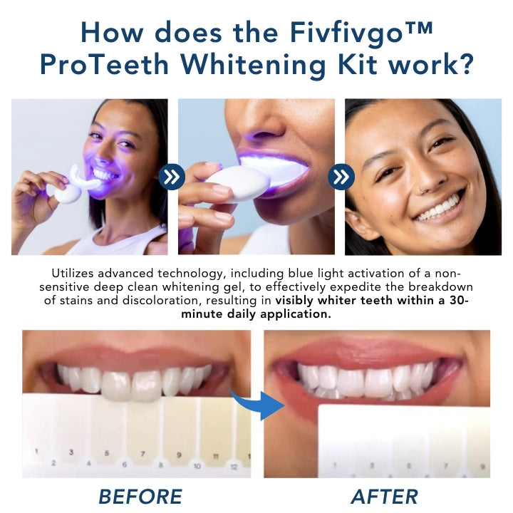 Fivfivgo™ ProTeeth Whitening Kit