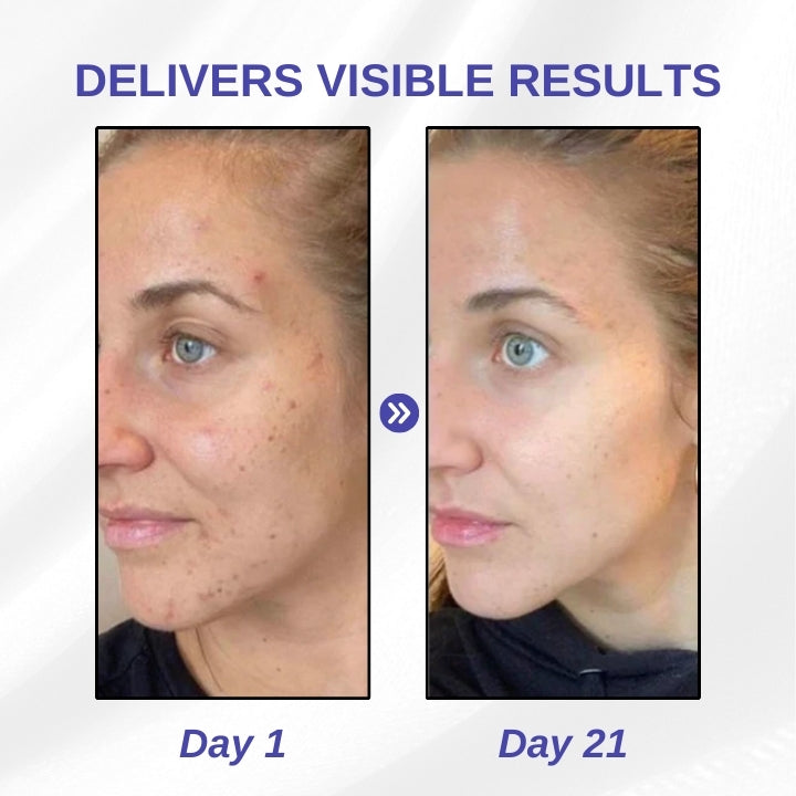 Fivfivgo™ Crème Imperfections Éclat Impeccable