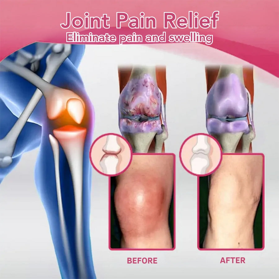 Fivfivgo™ Bee Venom Pain Relief Bone Healing Cream
